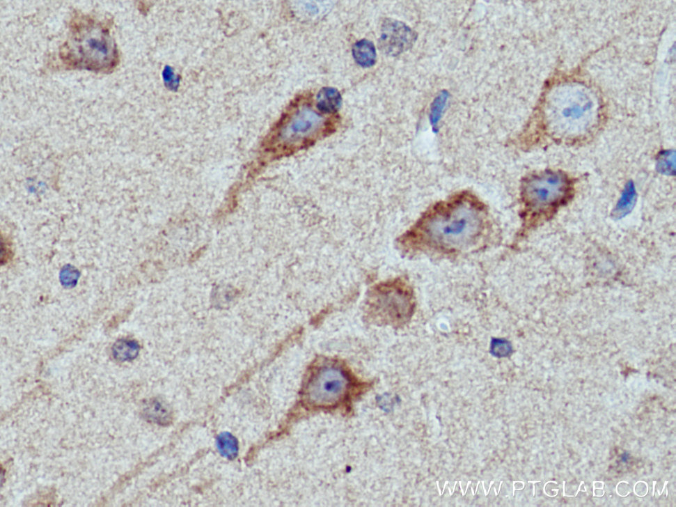 IHC staining of mouse brain using 21186-1-AP