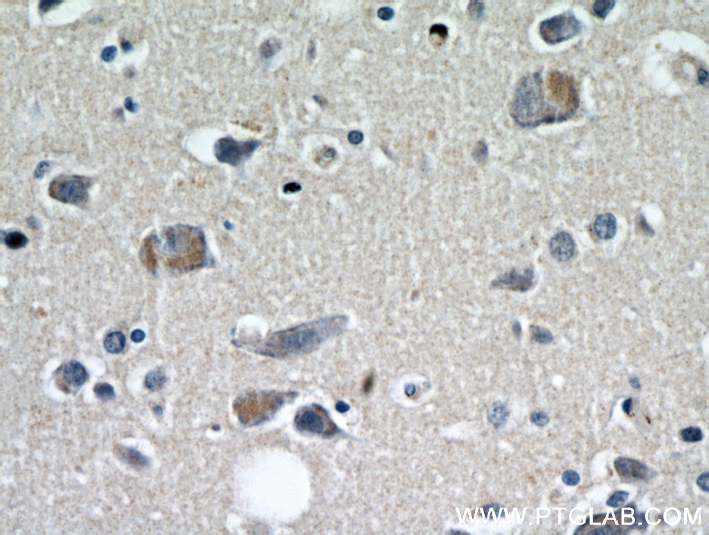 KIF5A Polyclonal antibody