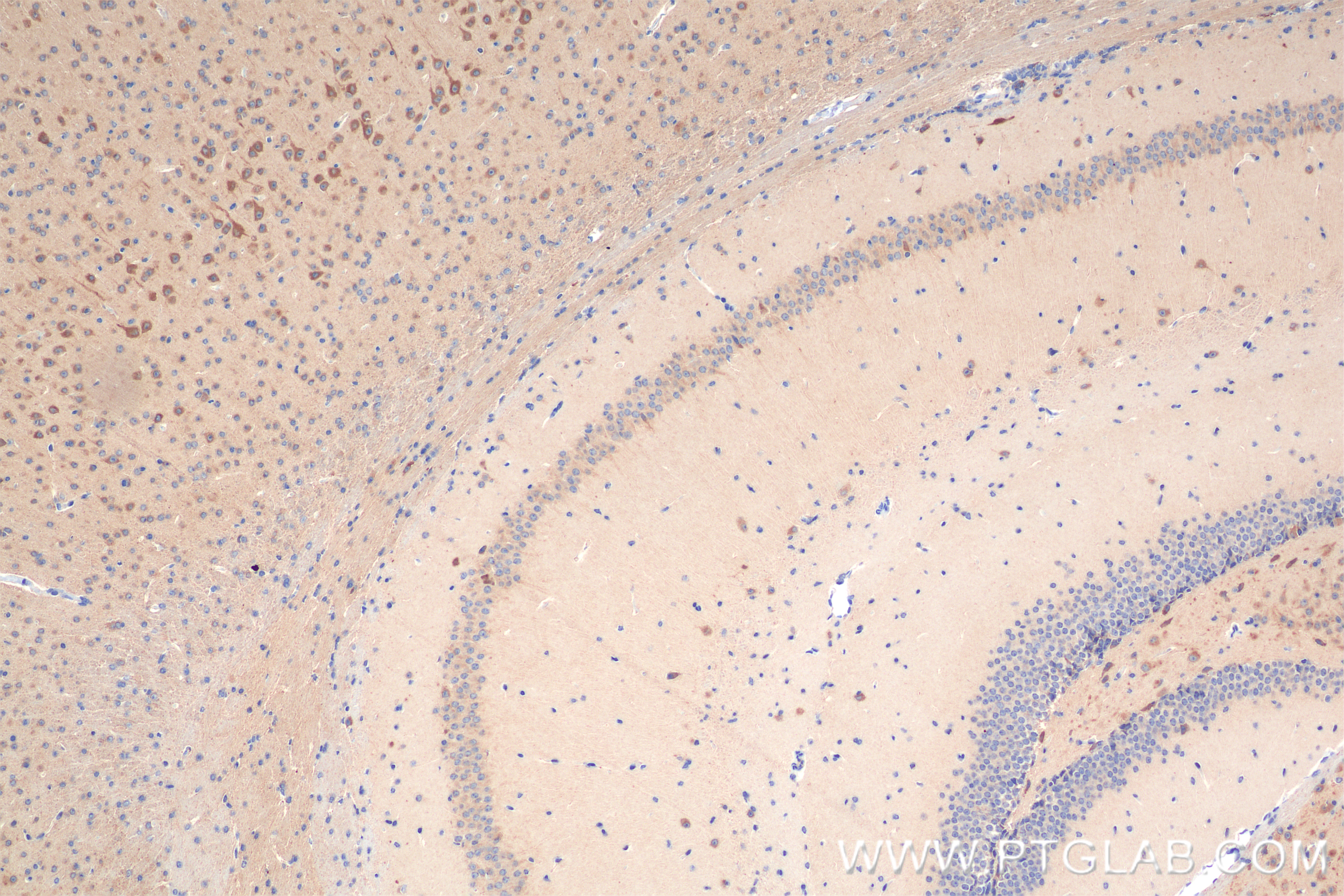 IHC staining of mouse brain using 84013-5-RR (same clone as 84013-5-PBS)