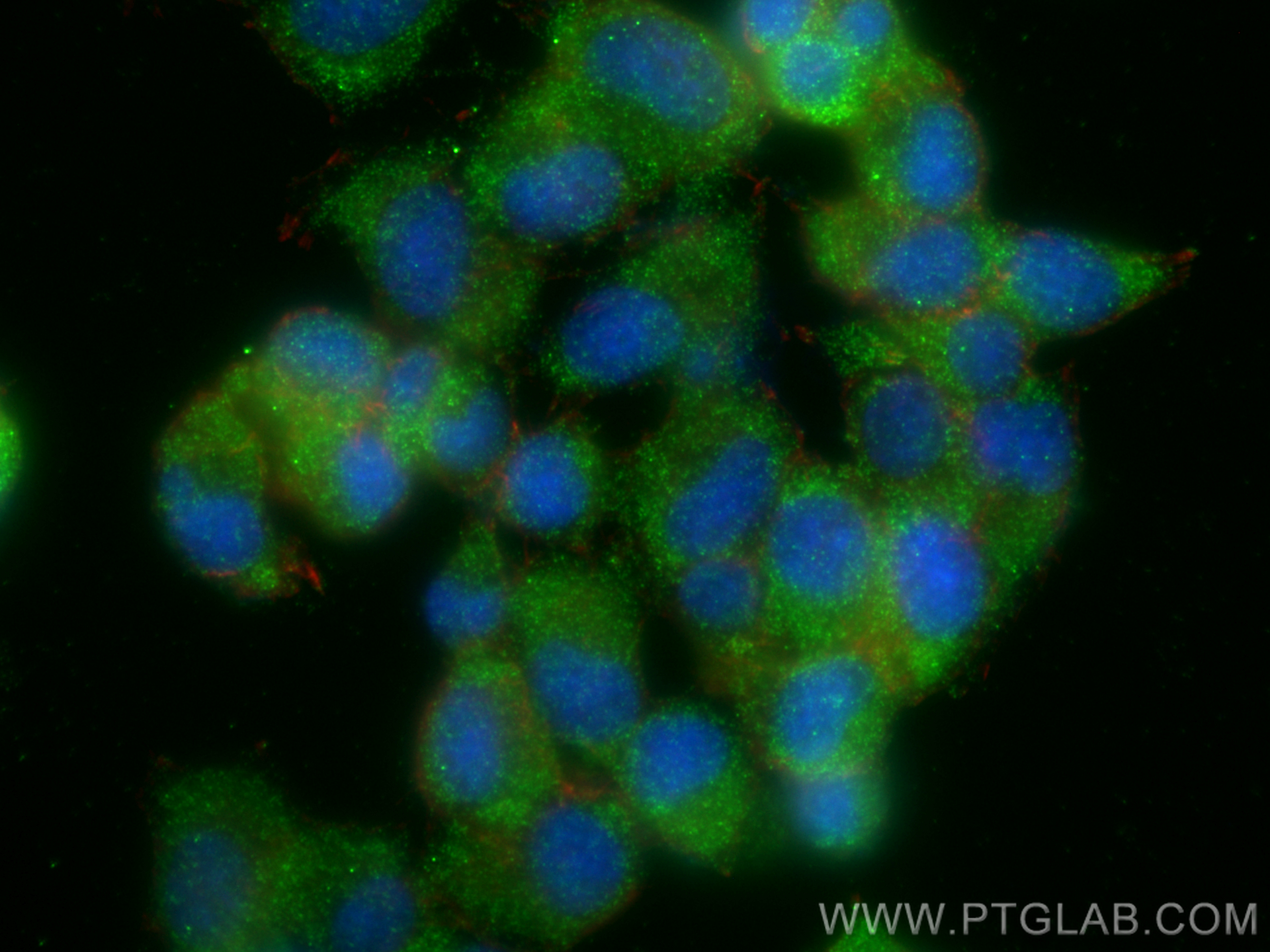 IF Staining of PC-12 using RMX00017