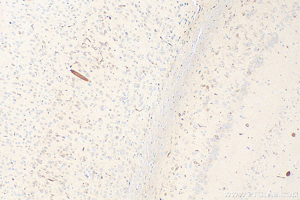 IHC staining of mouse brain using RMX00017