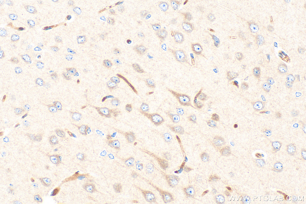 IHC staining of mouse brain using RMX00017