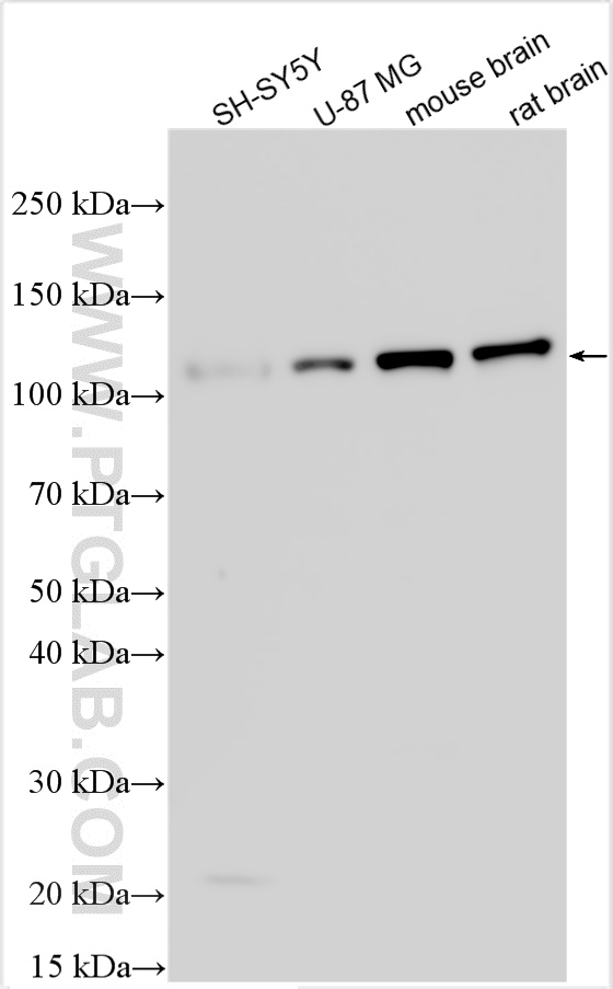 WB analysis using RMX00017