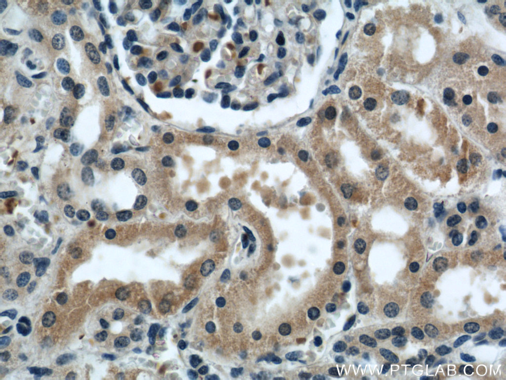 IHC staining of human kidney using 21632-1-AP