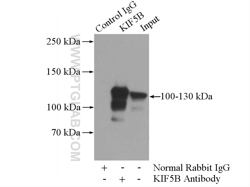 IP experiment of HepG2 using 21632-1-AP