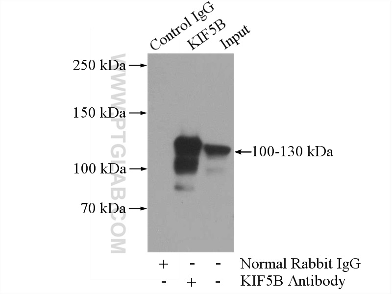 IP experiment of HepG2 using 21632-1-AP