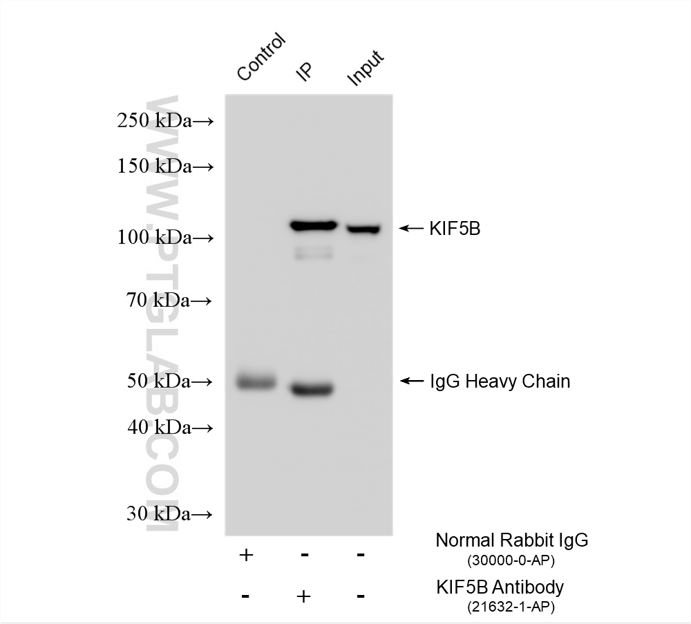 IP experiment of HepG2 using 21632-1-AP