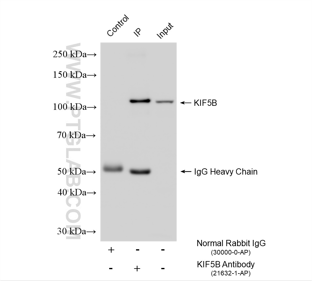 IP experiment of mouse heart using 21632-1-AP