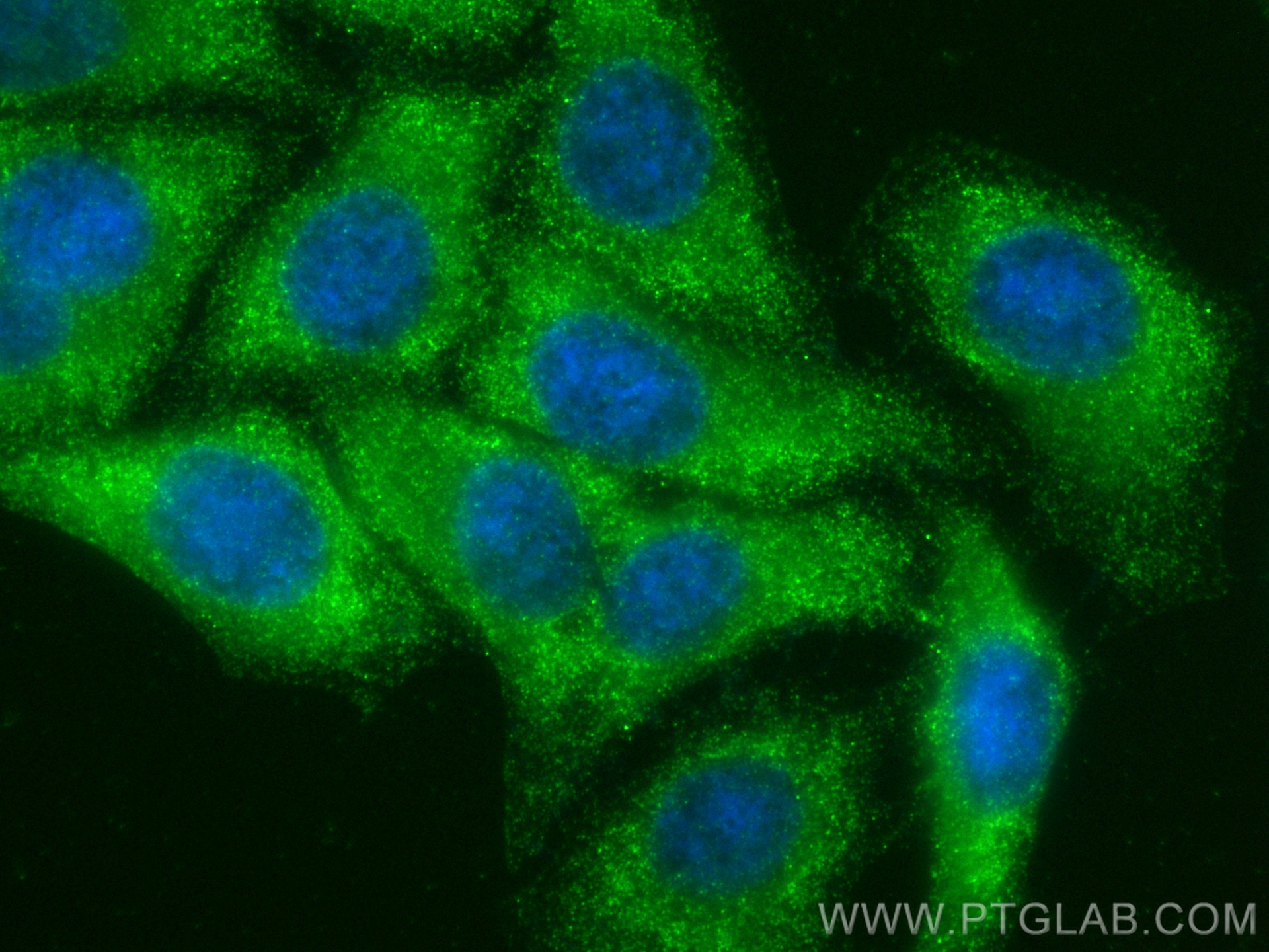 IF Staining of HepG2 using 82485-1-RR (same clone as 82485-1-PBS)