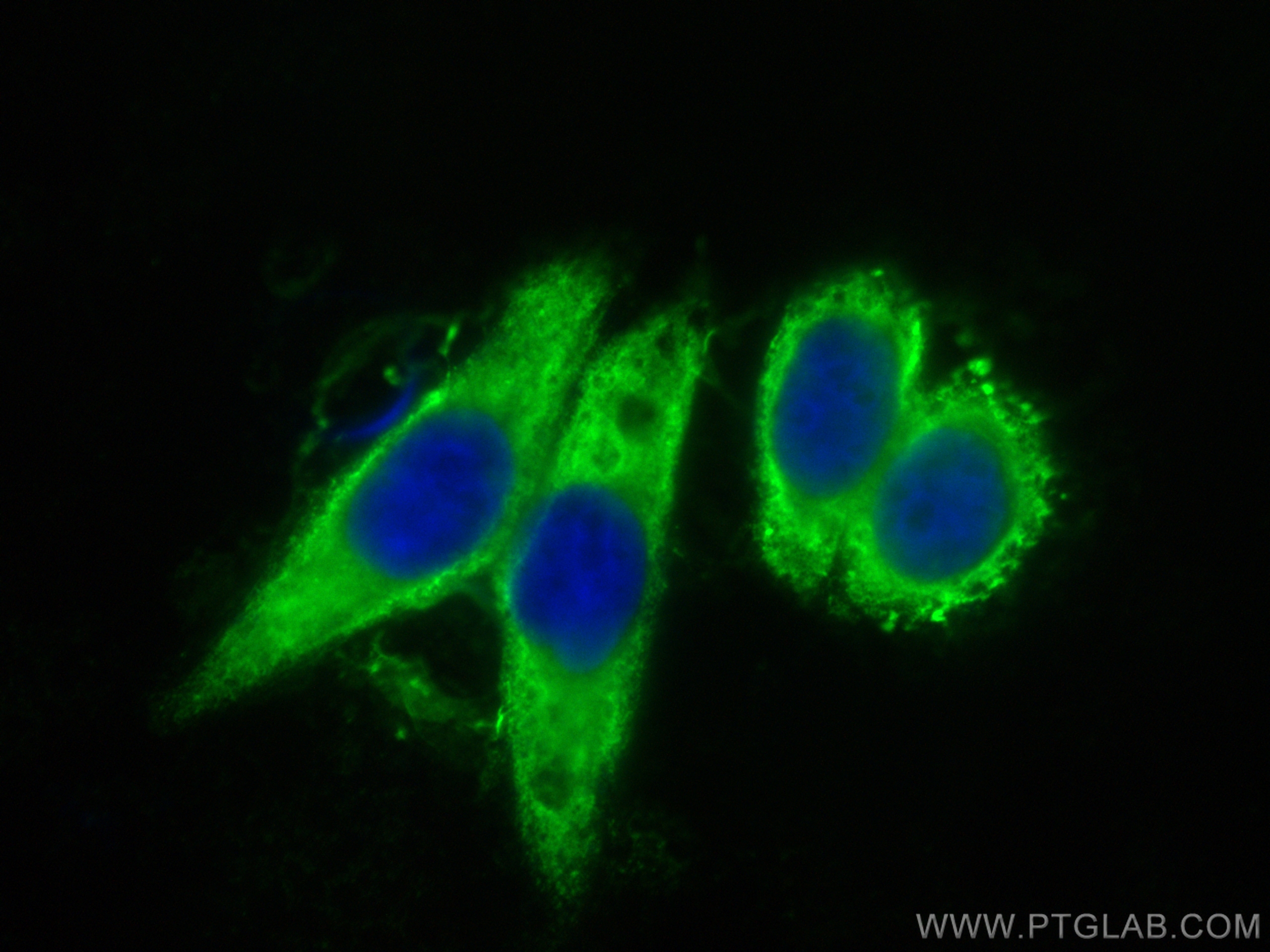 IF Staining of HepG2 using CL488-82485