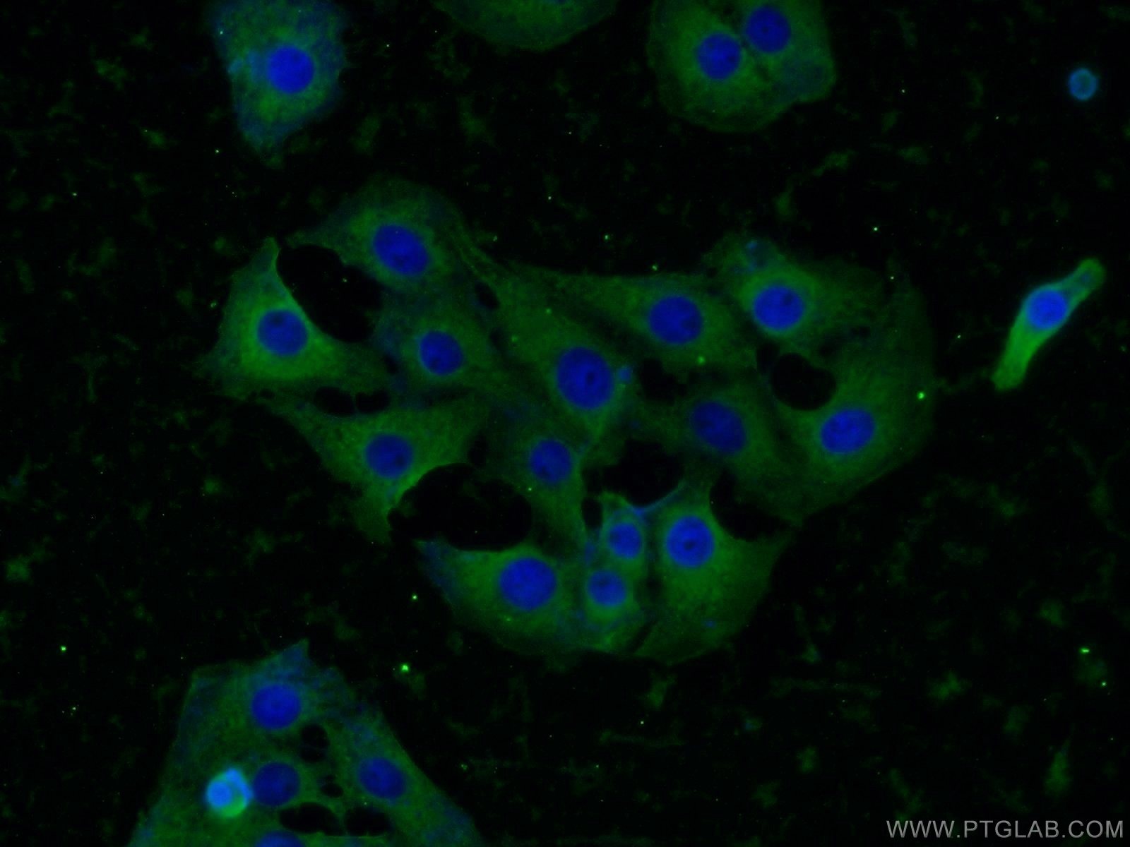 IF Staining of SH-SY5Y using 25897-1-AP