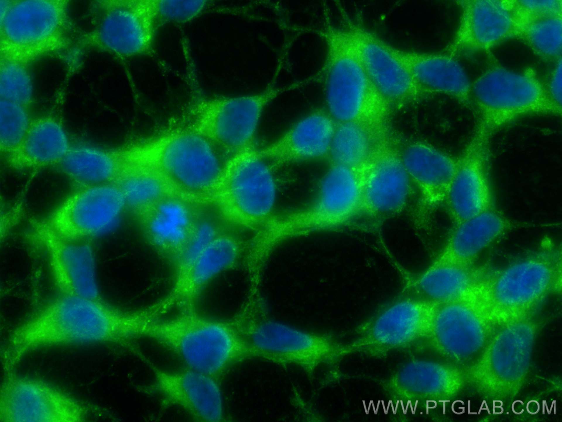 IF Staining of SH-SY5Y using 25897-1-AP