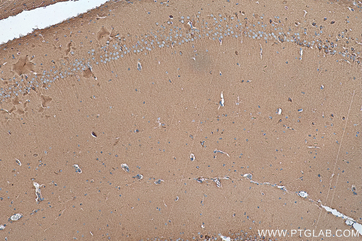 IHC staining of mouse brain using 25897-1-AP