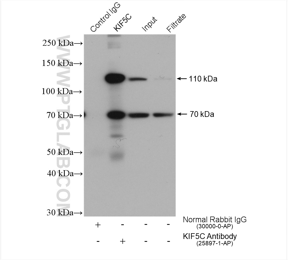 IP experiment of mouse brain using 25897-1-AP