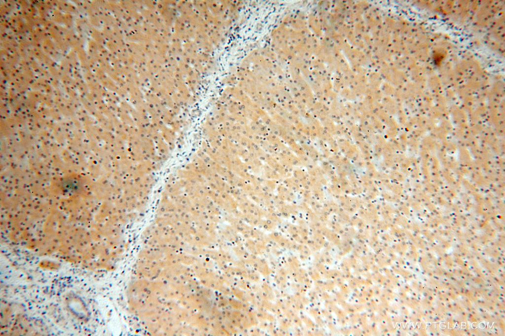 IHC staining of human liver using 17290-1-AP