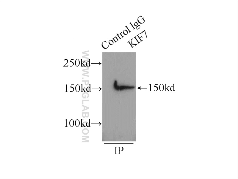 IP experiment of HEK-293 using 24693-1-AP