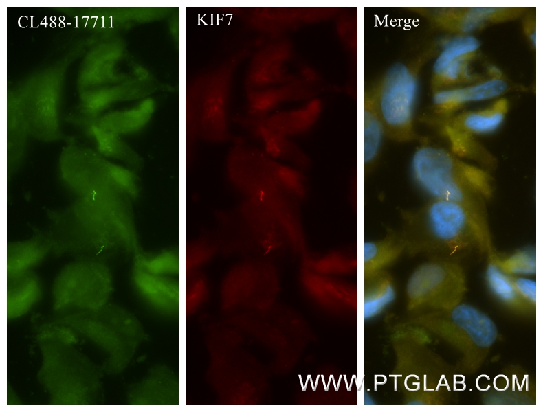 IF Staining of hTERT-RPE1 using 86970-1-RR IF Staining of hTERT-RPE1 using 86970-1-RR