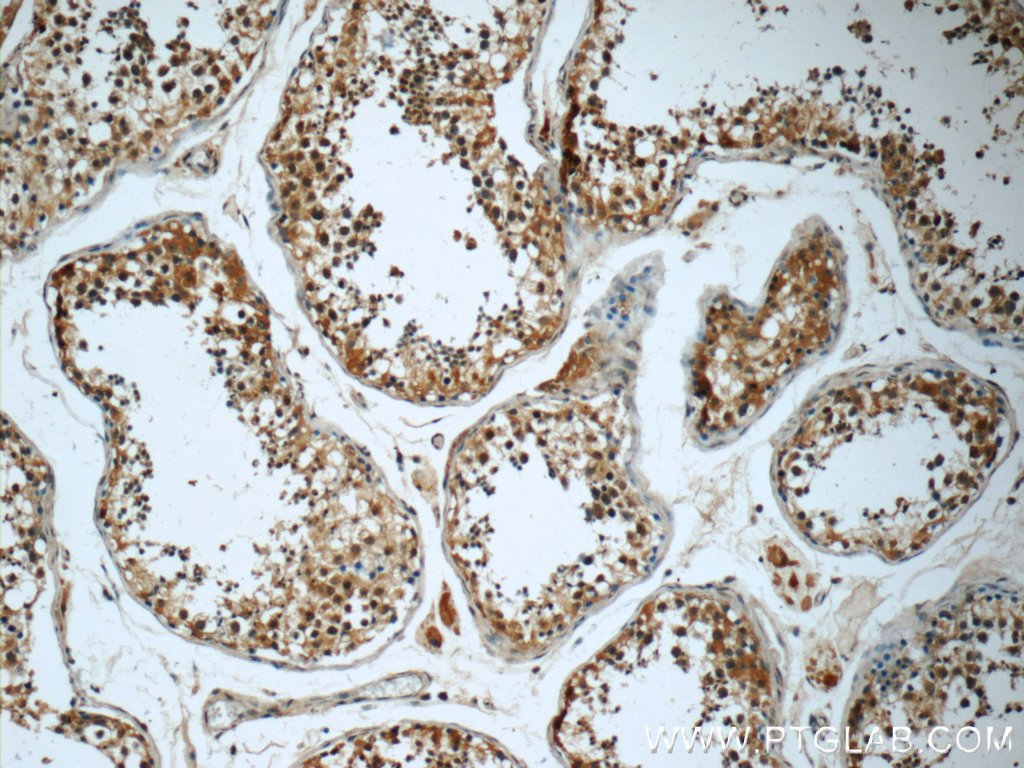 IHC staining of human testis using 60266-1-Ig