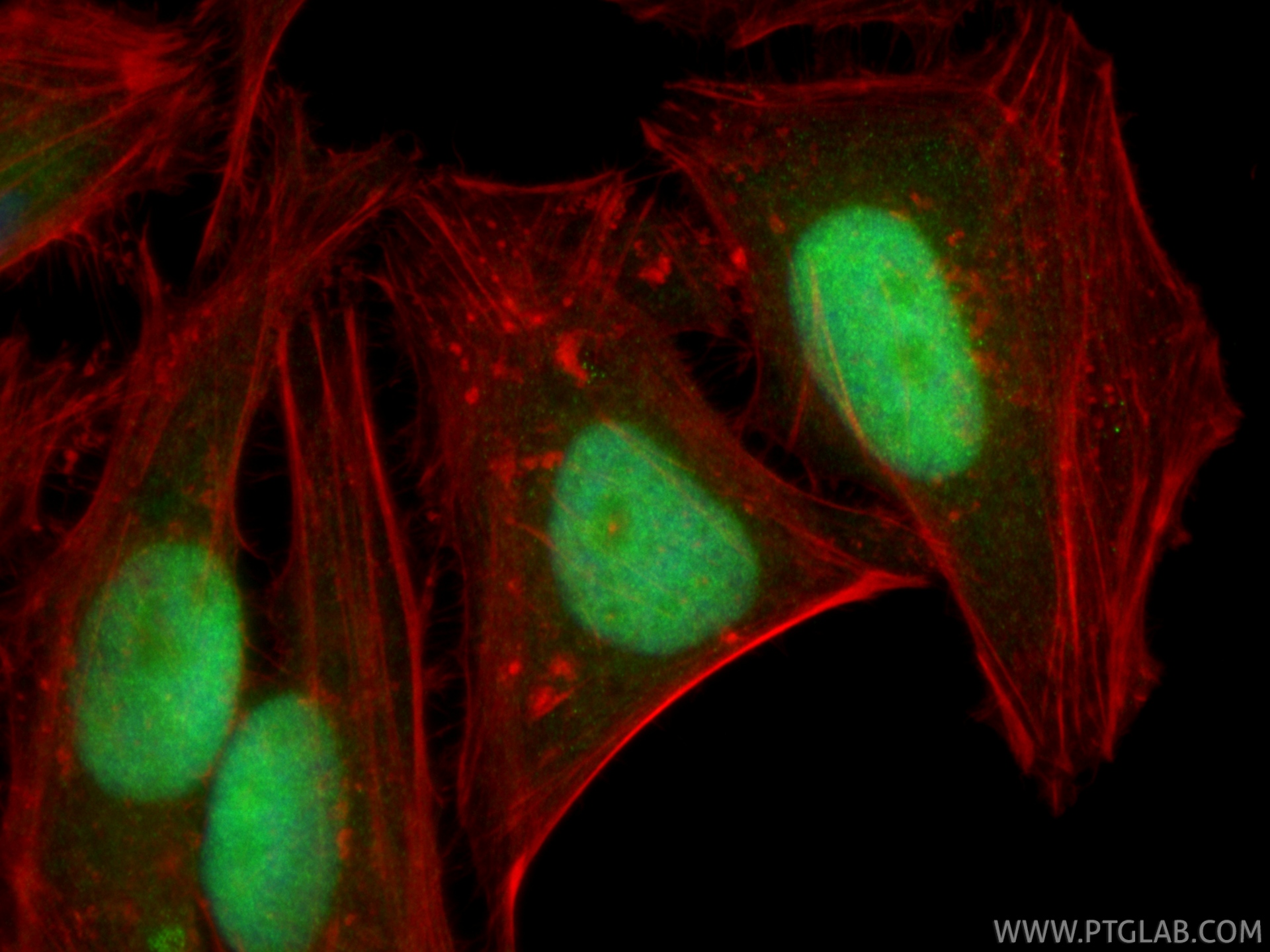 Immunofluorescent analysis of (4% PFA) fixed HeLa cells using KIFC1 antibody (20790-1-AP) at dilution of 1:200 and CoraLite®488-Conjugated Goat Anti-Rabbit IgG(H+L) (<a class='green' href='/productredirect?CatalogNo=SA00013-2' target='_blank'>SA00013-2</a>), CL594-phalloidin (red). IF Staining of HeLa using 20790-1-AP