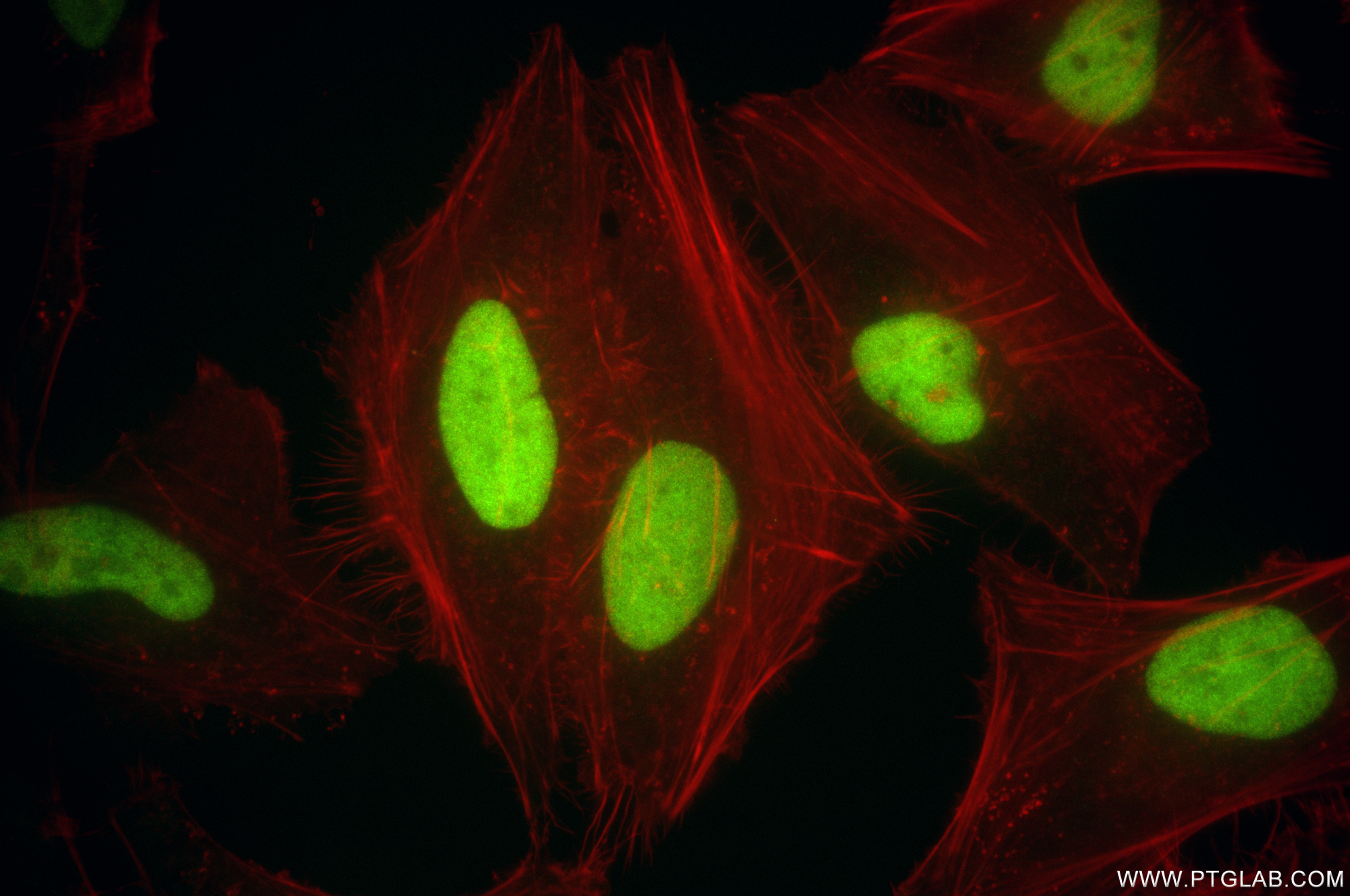 IF Staining of HeLa using 85981-1-RR (same clone as 85981-1-PBS)