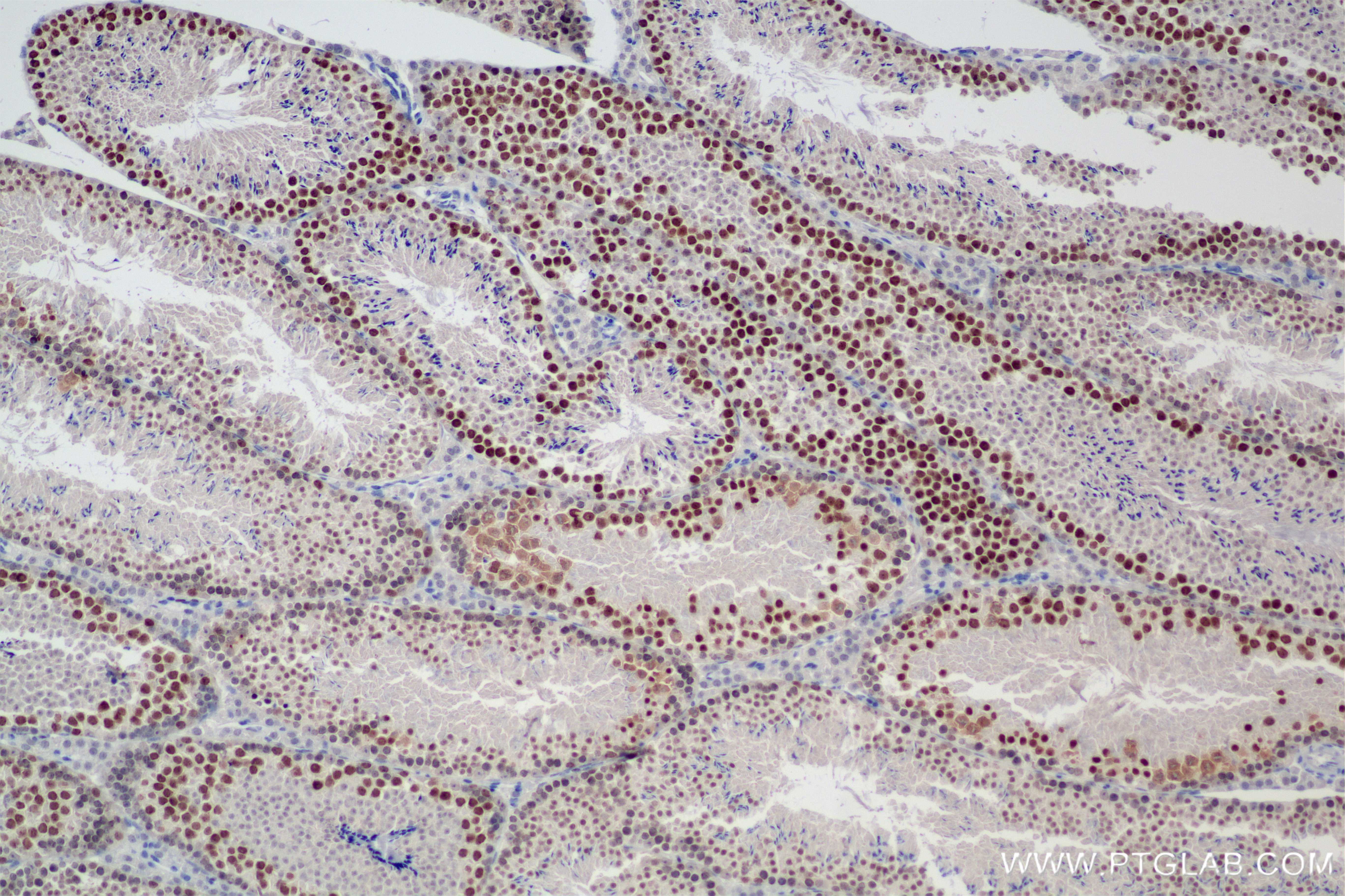 IHC staining of mouse testis using 85981-1-RR (same clone as 85981-1-PBS)