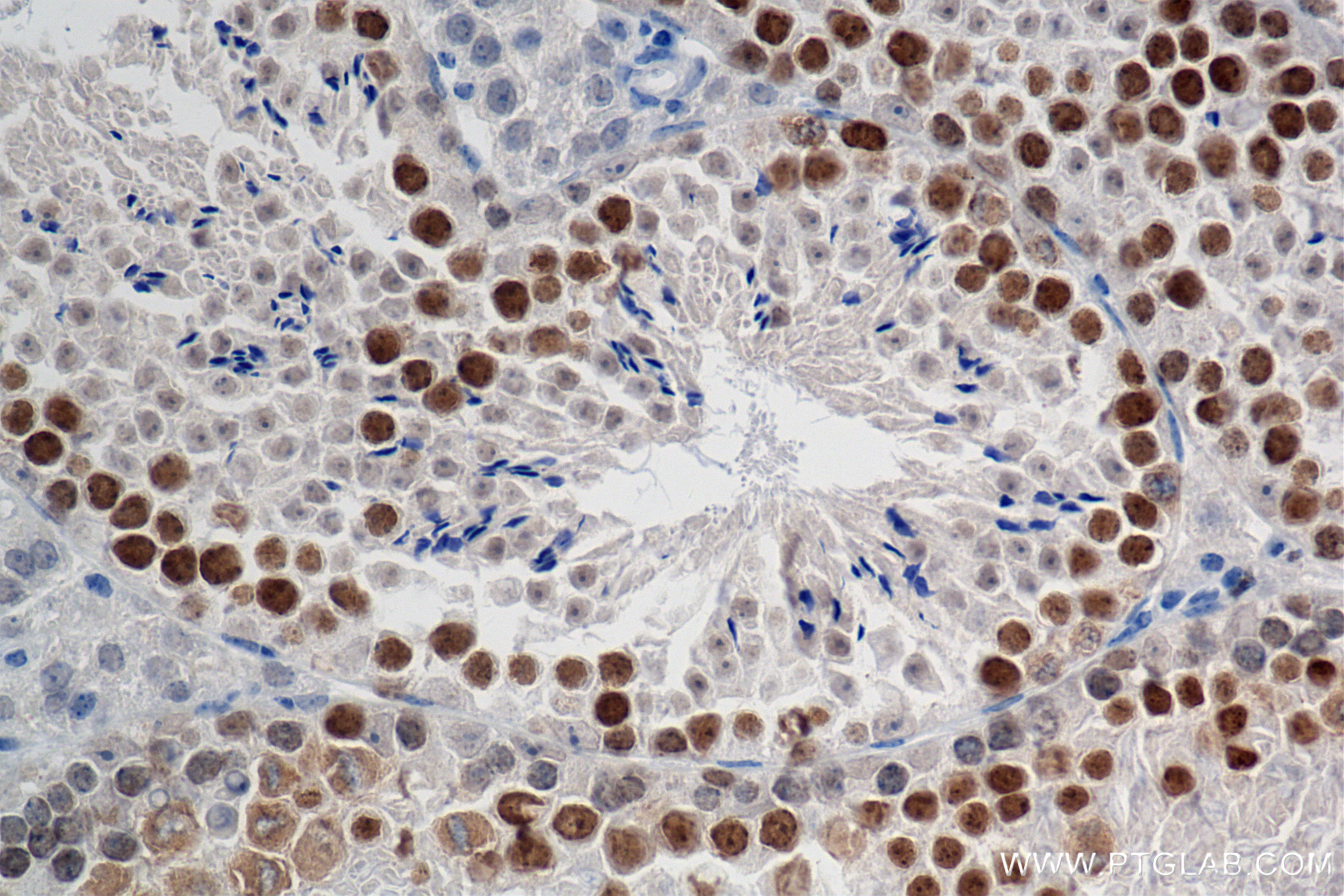 IHC staining of mouse testis using 85981-1-RR (same clone as 85981-1-PBS)