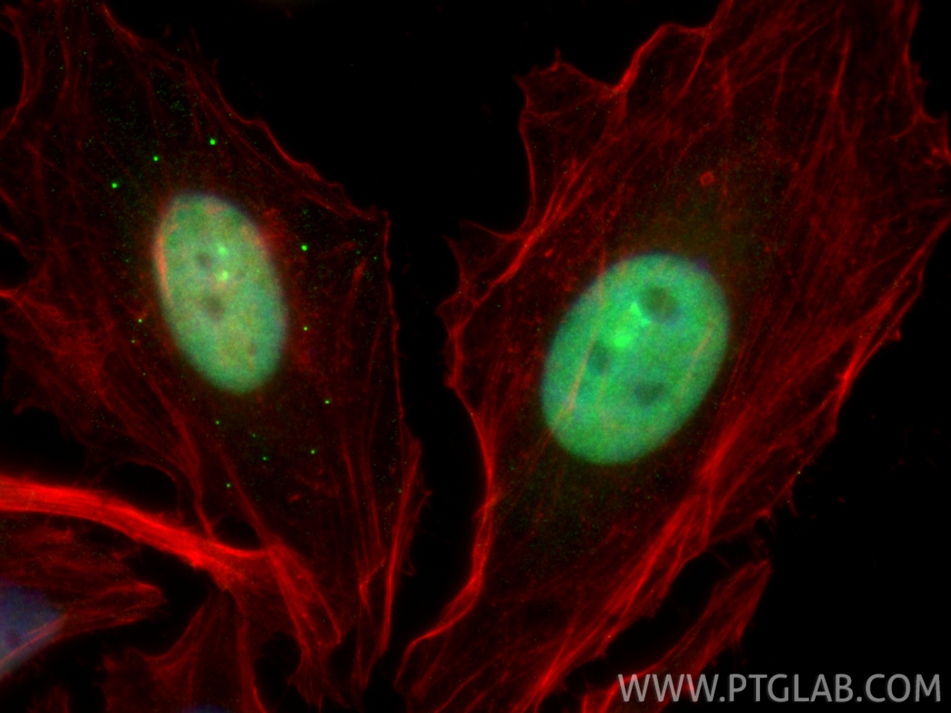 IF Staining of HeLa using CL488-85981