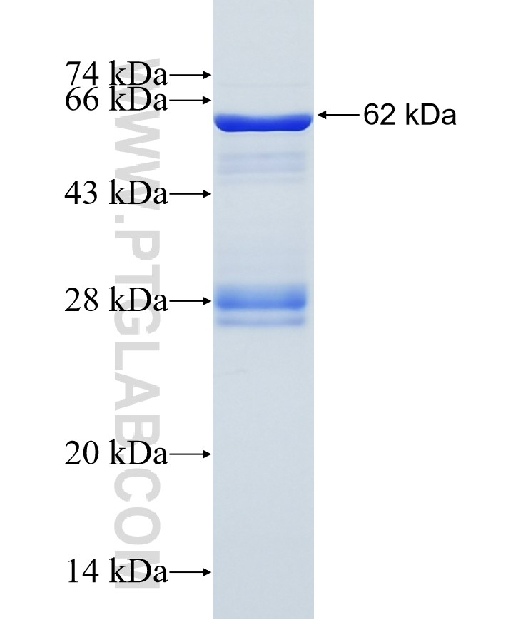 KIFC1 fusion protein Ag14338 SDS-PAGE KIFC1 fusion protein Ag14338 SDS-PAGE
