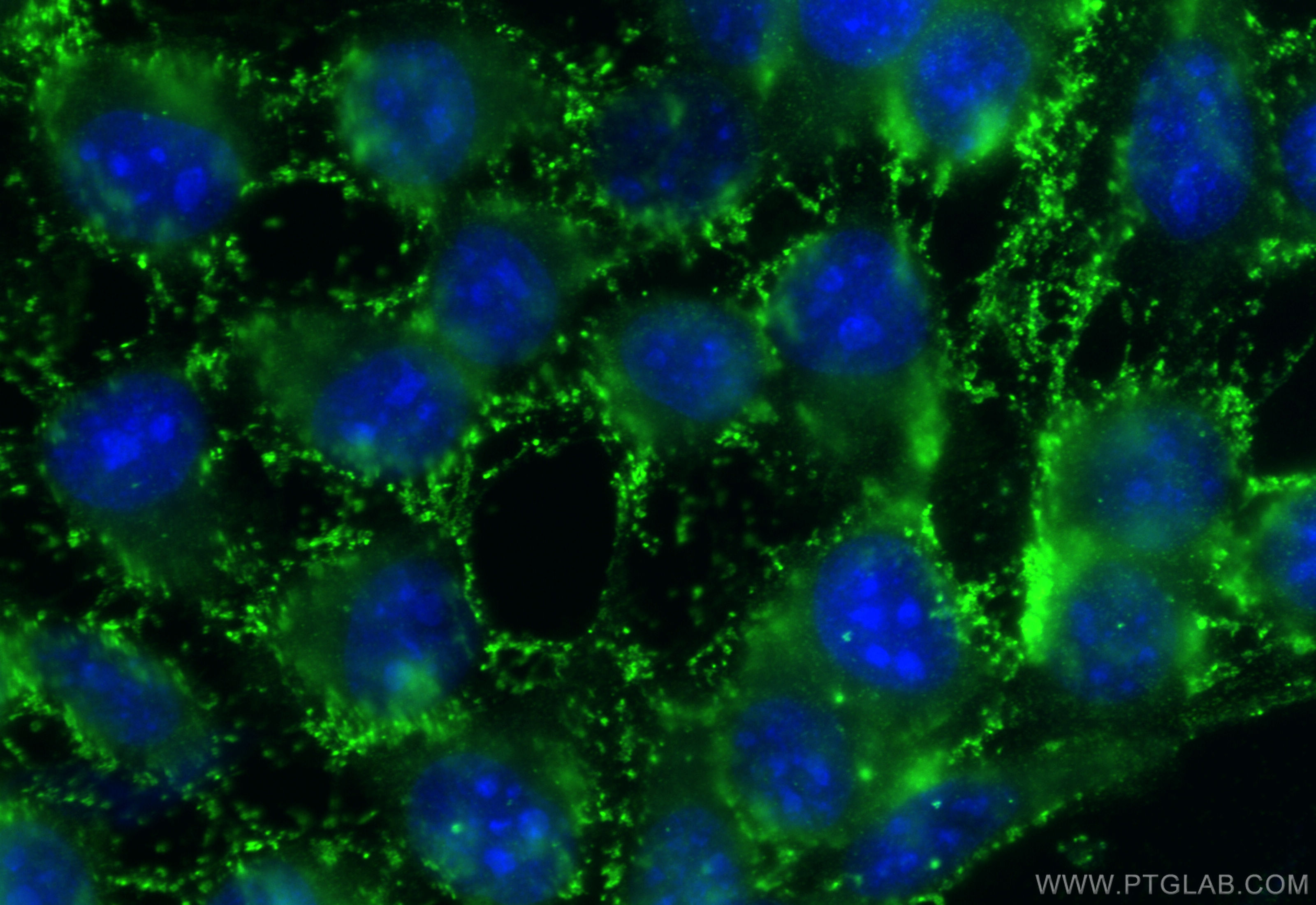 IF Staining of A431 using 27470-1-AP