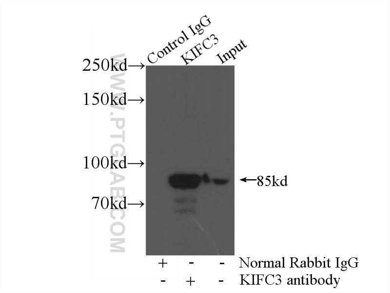 IP experiment of mouse kidney using 10125-2-AP (same clone as 10125-2-PBS)