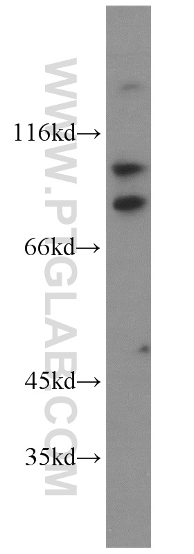 WB analysis of mouse lung using 10125-2-AP (same clone as 10125-2-PBS)