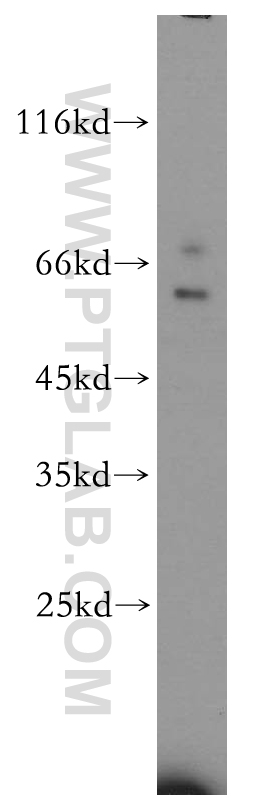 WB analysis of human liver using 18966-1-AP