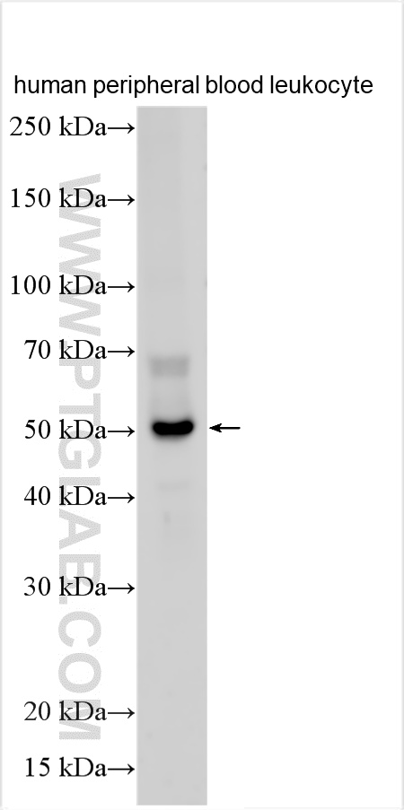 WB analysis using 13335-1-AP