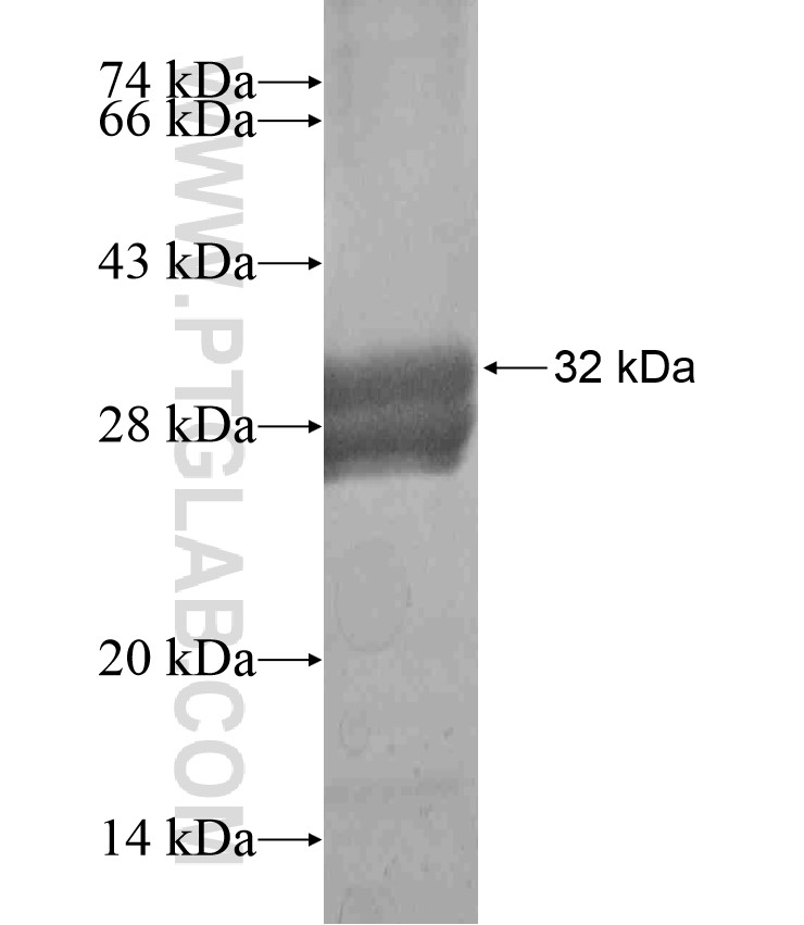 KIR3DL3 fusion protein Ag18217 SDS-PAGE KIR3DL3 fusion protein Ag18217 SDS-PAGE