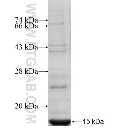 KIR3DX1 fusion protein Ag11220 SDS-PAGE