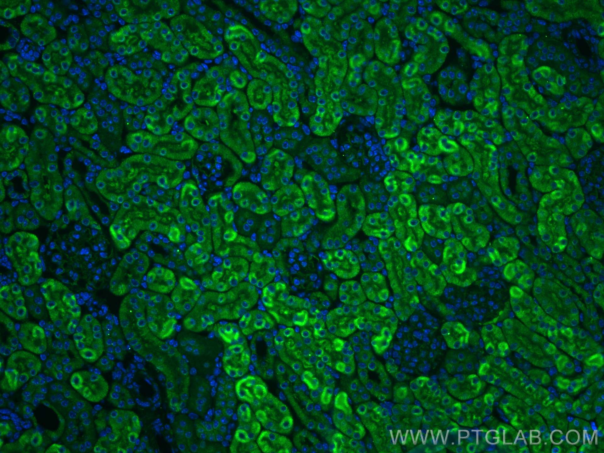 IF Staining of mouse kidney using 22232-1-AP