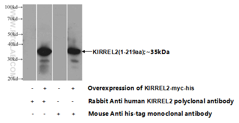 KIRREL2