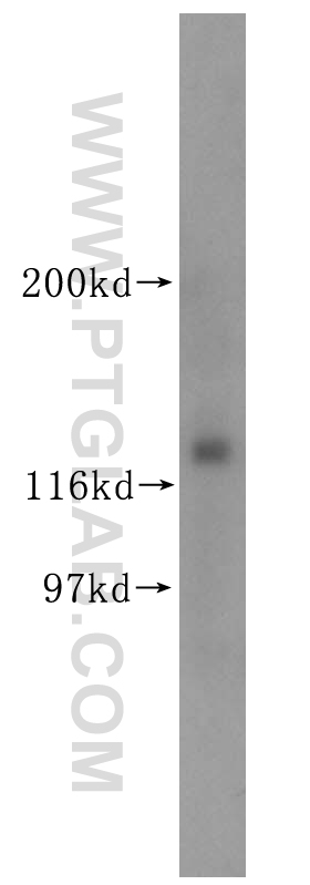 WB analysis of mouse testis using 18055-1-AP