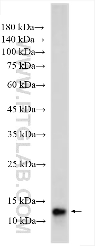 WB analysis of human placenta using 18375-1-AP