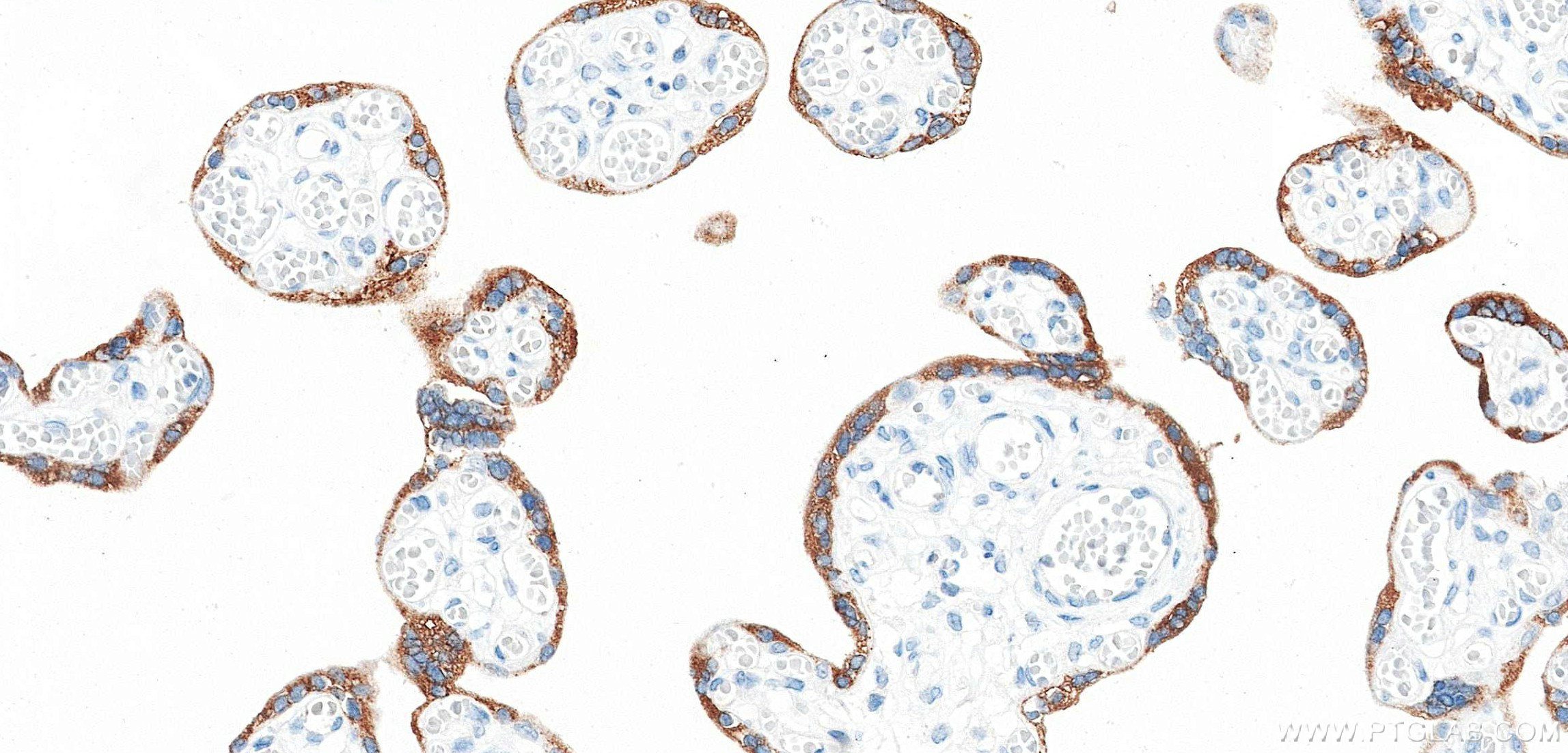 IHC staining of human placenta using 88055-1-RR (same clone as 88055-1-PBS) IHC staining of human placenta using 88055-1-RR (same clone as 88055-1-PBS)