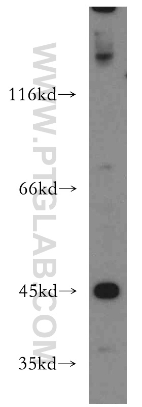 KISS1R-Specific Polyclonal antibody