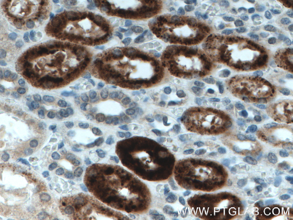 IHC staining of human kidney using 28100-1-AP