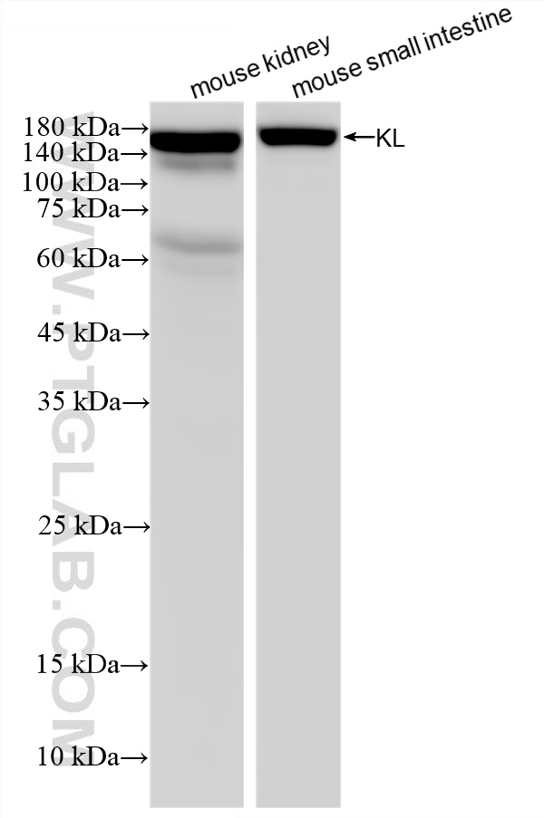 WB analysis using 87584-1-RR (same clone as 87584-1-PBS) WB analysis using 87584-1-RR (same clone as 87584-1-PBS)