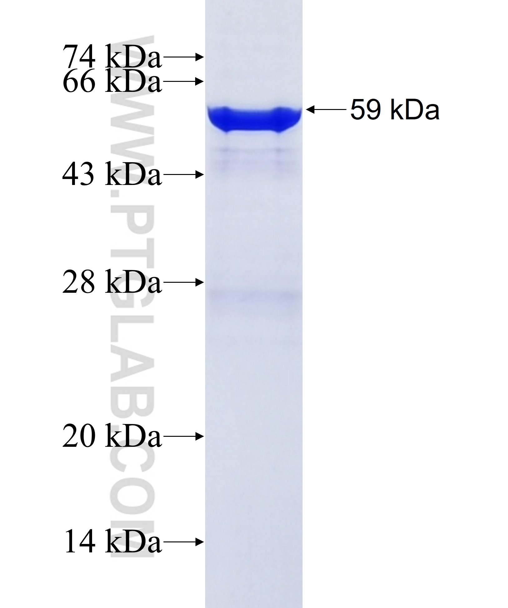 KLB fusion protein Ag36993 SDS-PAGE KLB fusion protein Ag36993 SDS-PAGE
