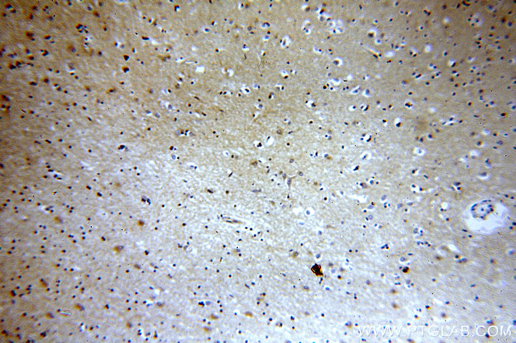 IHC staining of human brain using 19028-1-AP