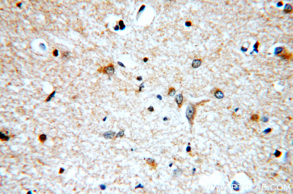 IHC staining of human brain using 19028-1-AP