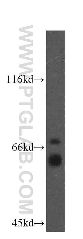 WB analysis of mouse brain using 19028-1-AP