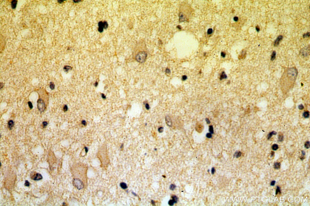 KLC2 Polyclonal antibody