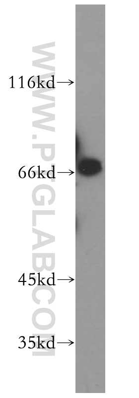 WB analysis of mouse testis using 17668-1-AP