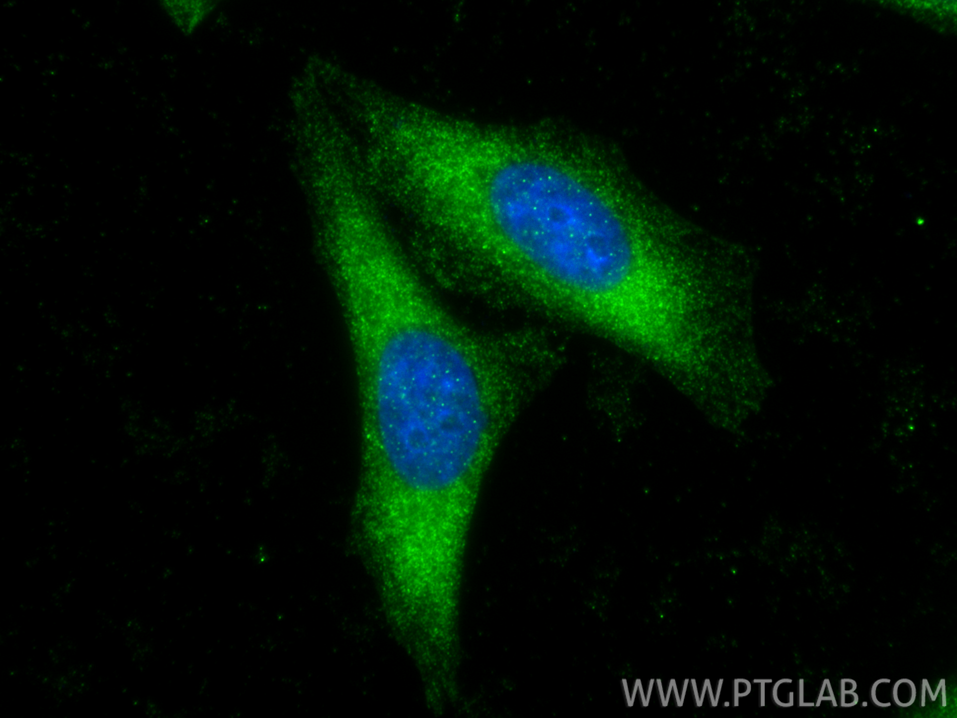 IF Staining of HepG2 using 11645-1-AP